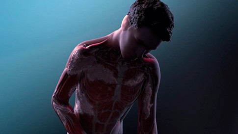A person suffering from a rare disease with an inside look at the body.