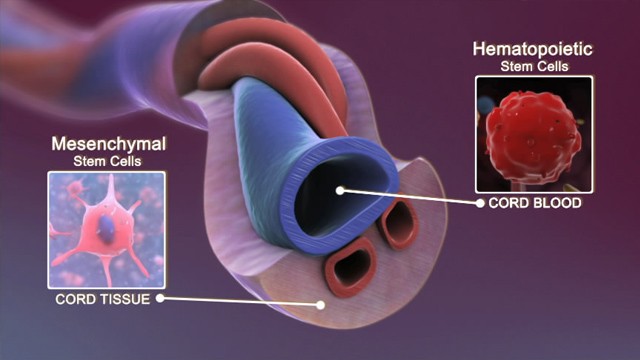 Umbilical cord blood with different types of stem cells.
