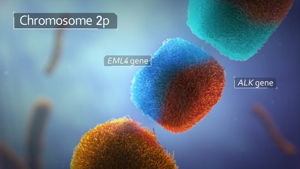 EML4-ALK rearrangement on chromosome 2p