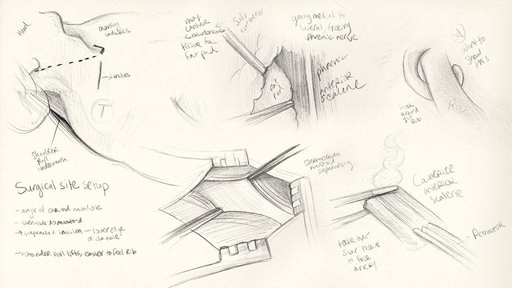 Sketches showing the step-by-step process of creating a surgical illustration